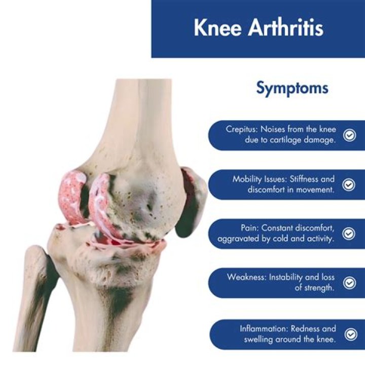 Can I get arthritis from my mother?