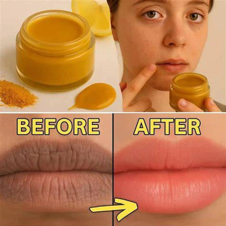 Can turmeric make your lips lighter?