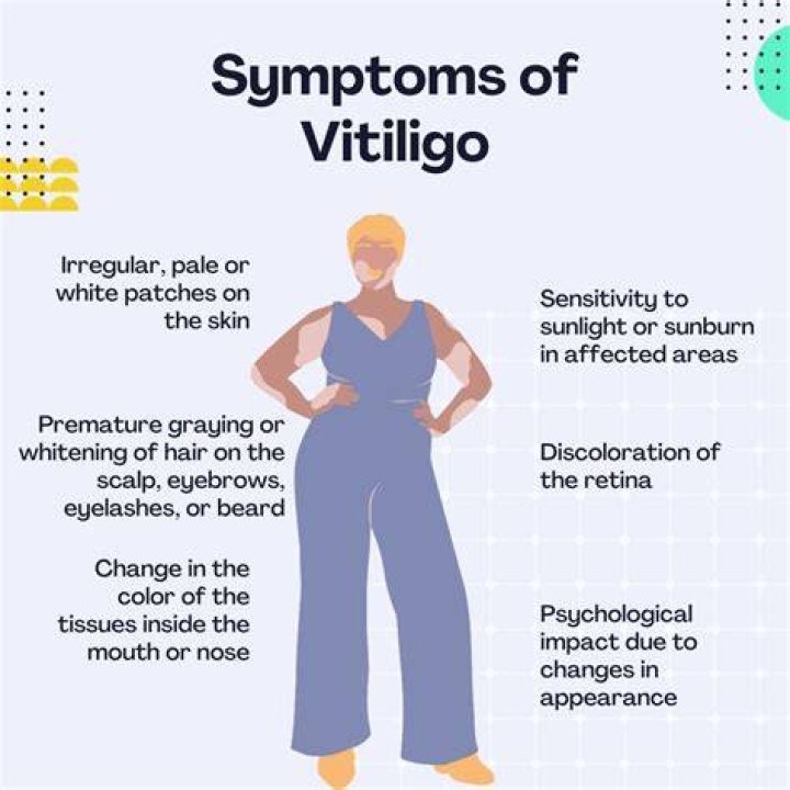 Does vitiligo cause mental illness?