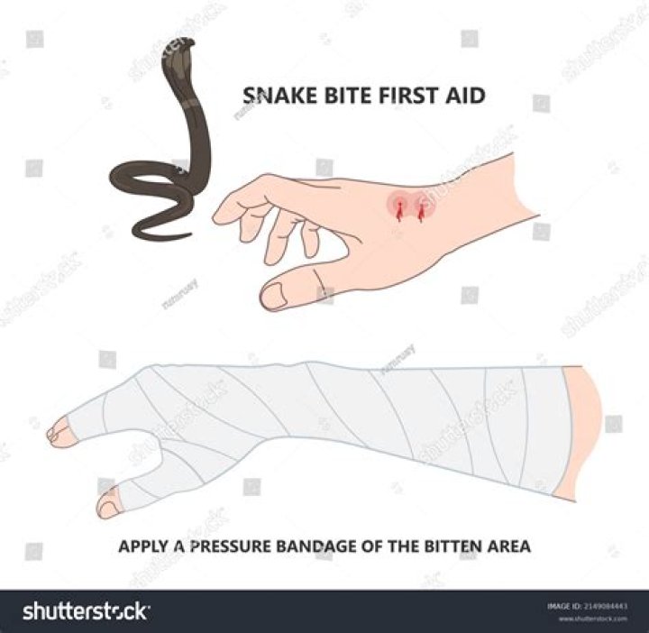 How do you stop a snake from coming?