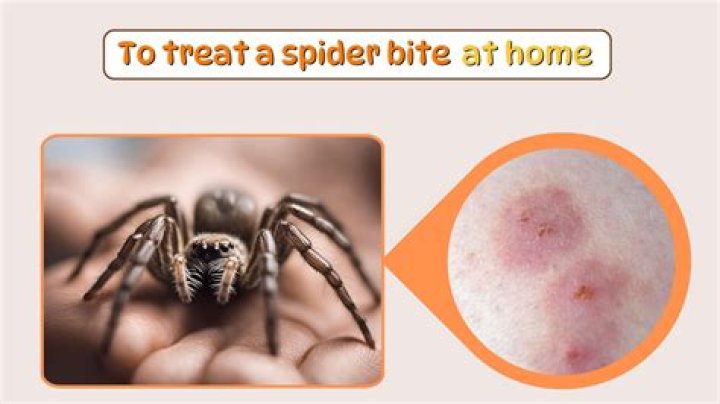 【How-to】Did my baby get bit by a spider