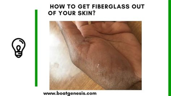 【How-to】How do you get glass out of your skin without tweezers