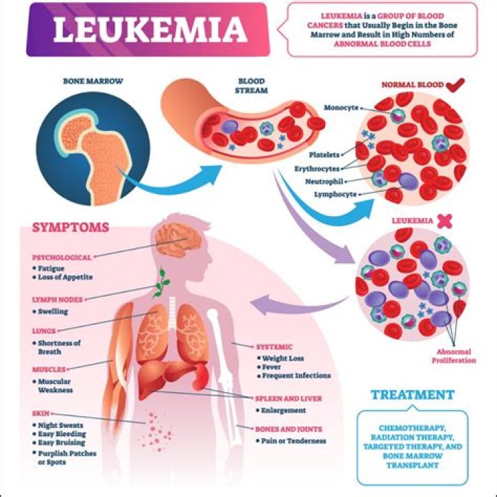 【How-to】How do you know if you have leukemia