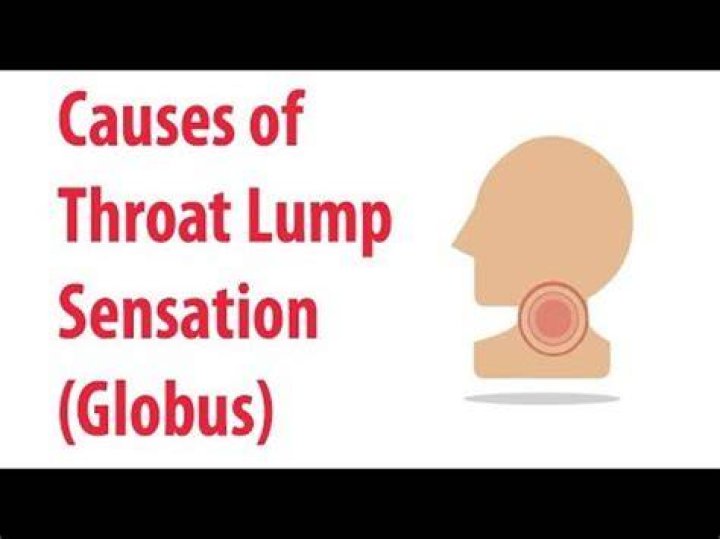 【How-to】How long does globus sensation last