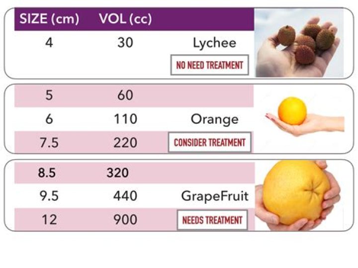 【How-to】How much does a 15 cm ovarian cyst weigh