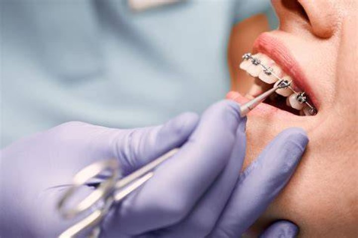 【How-to】How to be an orthodontist