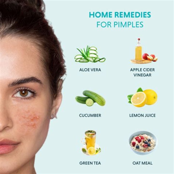 【How-to】How to Get Rid of a Blind Pimple