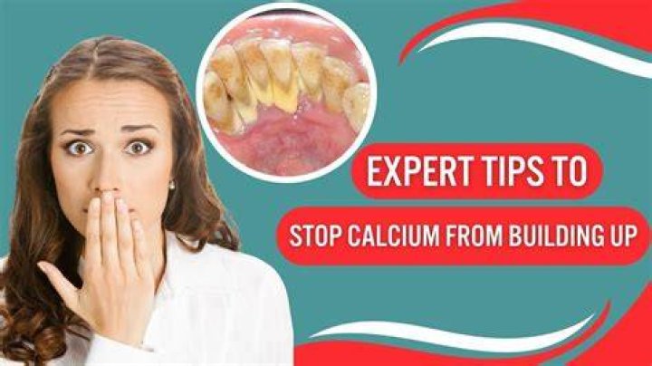 【How-to】How to get rid of calcium deposits on teeth