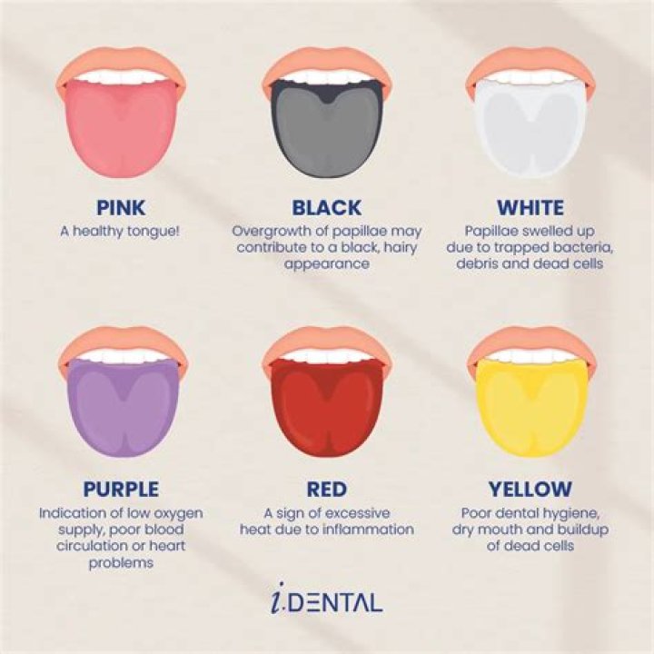 【How-to】What does it mean when you wear a white bandana