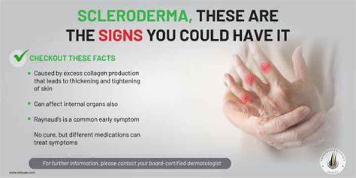 【How-to】What were your first symptoms of scleroderma