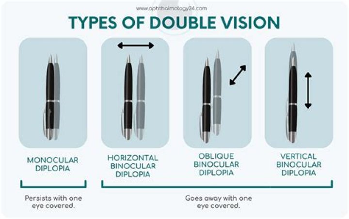 Is double vision normal?