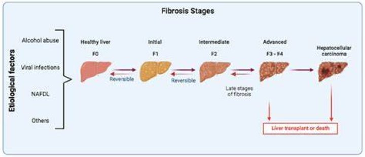Is f3 as bad as f6?