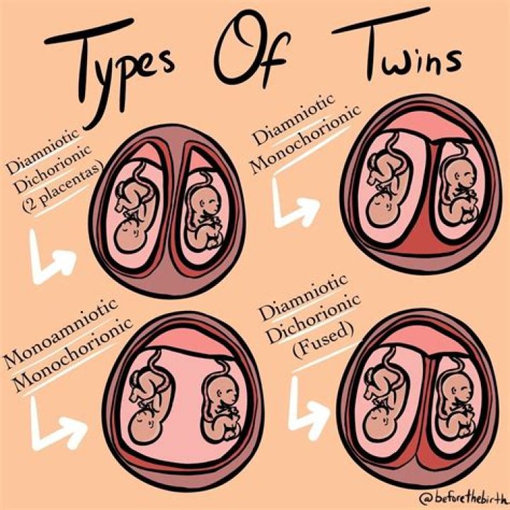 What are the 3 types of twins?
