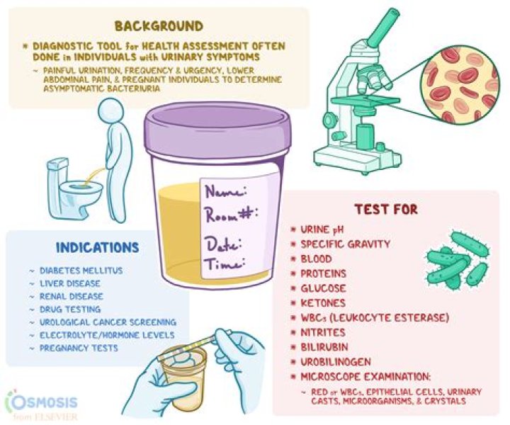 What are the abbreviations on a urine test?