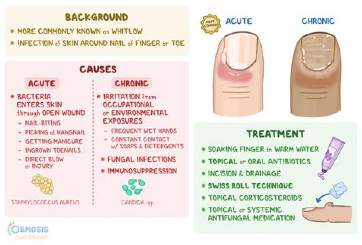 What causes cuticle infection?