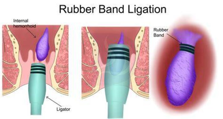 What does banding together mean?