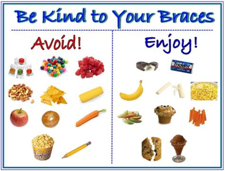 What food can I not eat with braces?