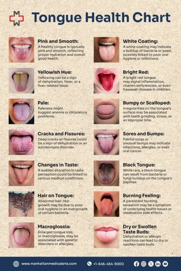 What happens if dry ice touches your tongue?