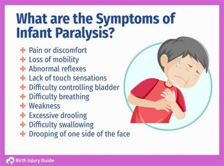 What infantile paralysis means?