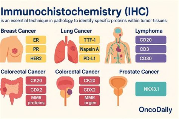 What is IHC used for?
