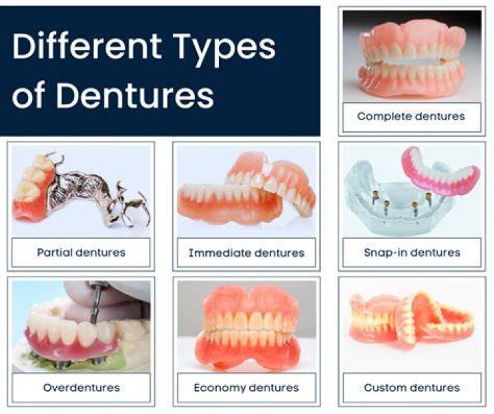 What is it like living with dentures?