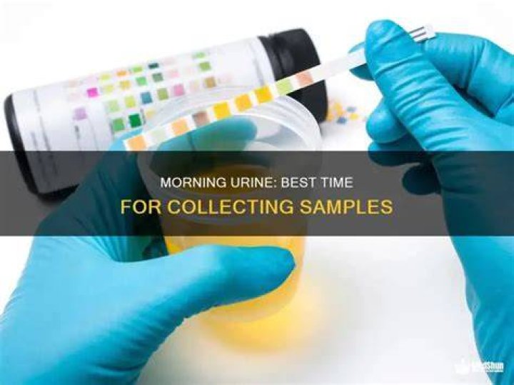 What is the best time to collect urine sample?