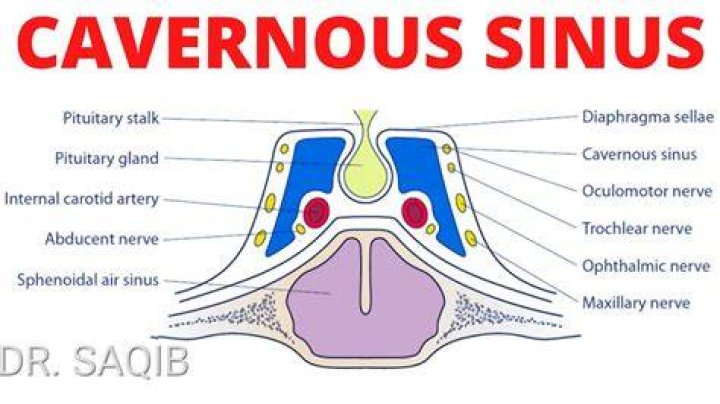 What is the closest meaning to cavernous?