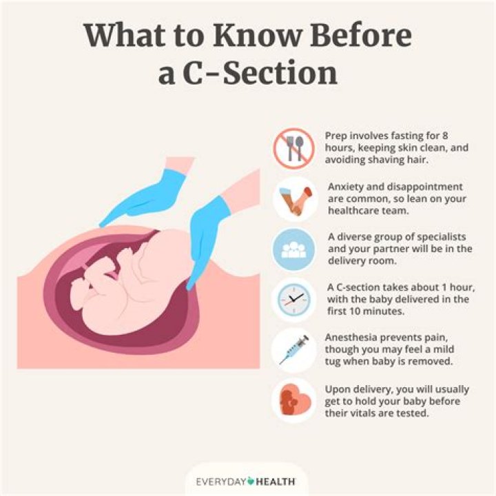 Why C-section is not good?