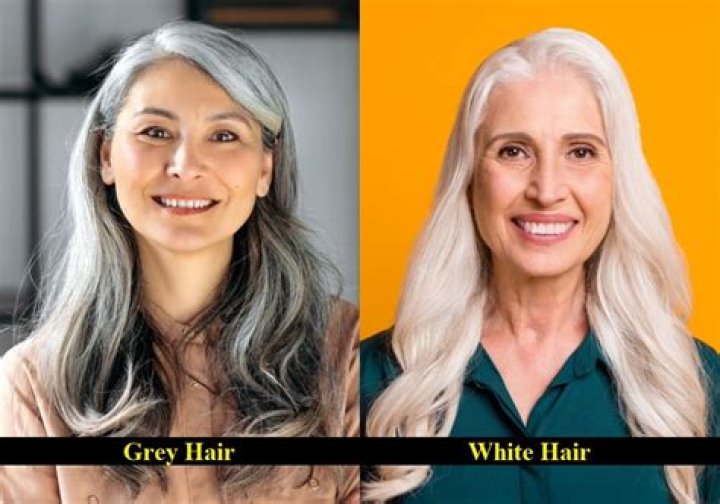 Why do I have white hair instead of gray?