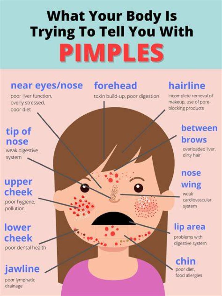Why do my pimples smell?