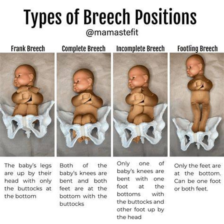 Why do they call it breech?