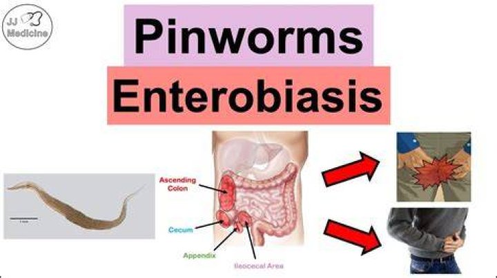 Why do you get pinworms?